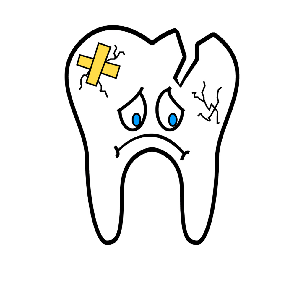 Περιοδοντίτιδα στα δόντια